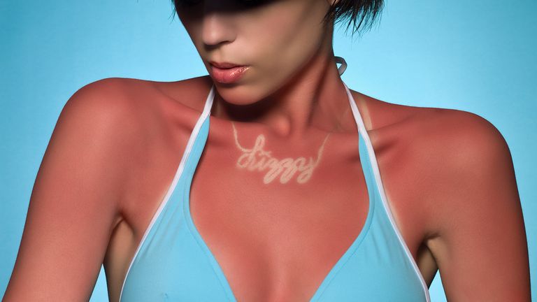 Portrait of woman with sunburn