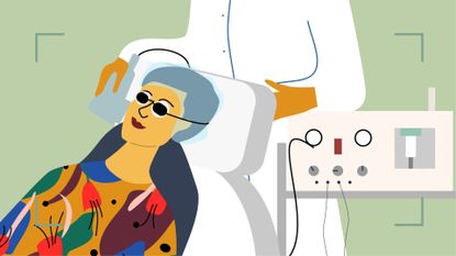 illustration of a woman having laser hair removal on the face 