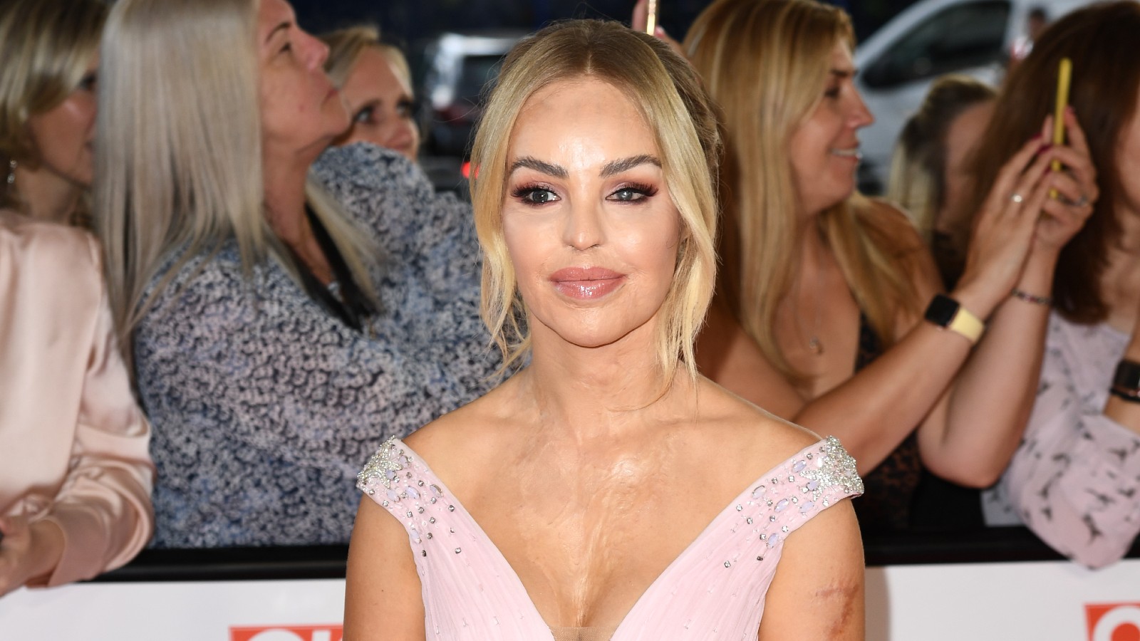 Who is Katie Piper is she married and does she have kids