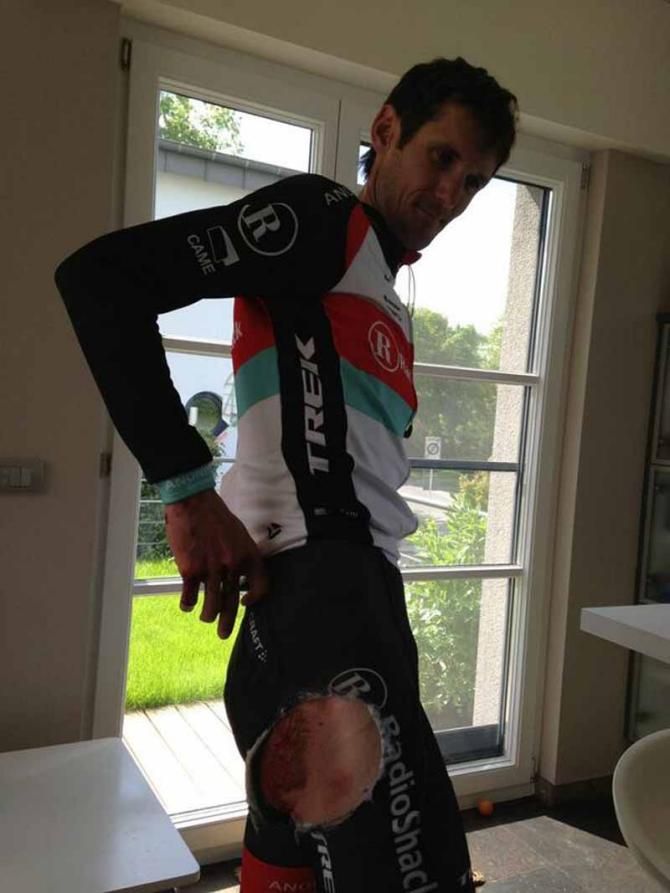 Fr&auml;nk Schleck shows off his injury, after being hit by car