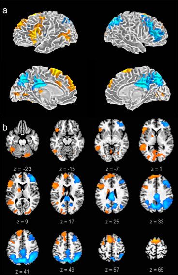 MRI brain images of freestyle rappers