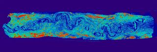 This scan of a nerve (8 millimeters long) associated with the floor of the mouth in a fin whale reveals how the nerve's core meanders like a river, but in three dimensions.