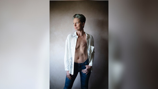 Portrait of Liz O'Riordan pictured with an unbuttoned shirt revealing her healed chest post-mastectomy