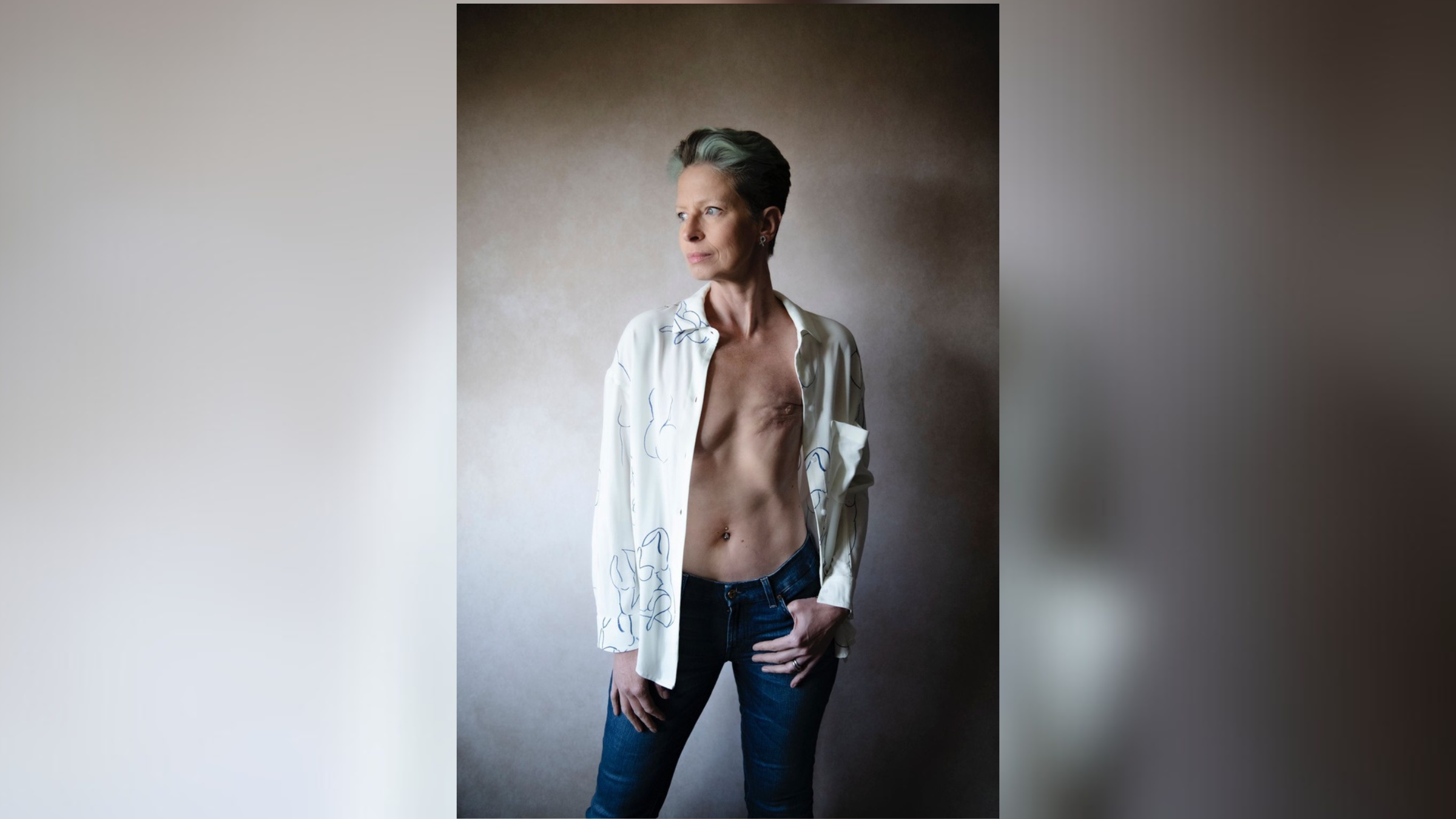 Portrait of Liz O'Riordan with her shirt unbuttoned to reveal her healed breasts after a mastectomy