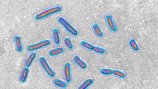 Pseudomonas aeruginosa as seen underneath a microscope.
