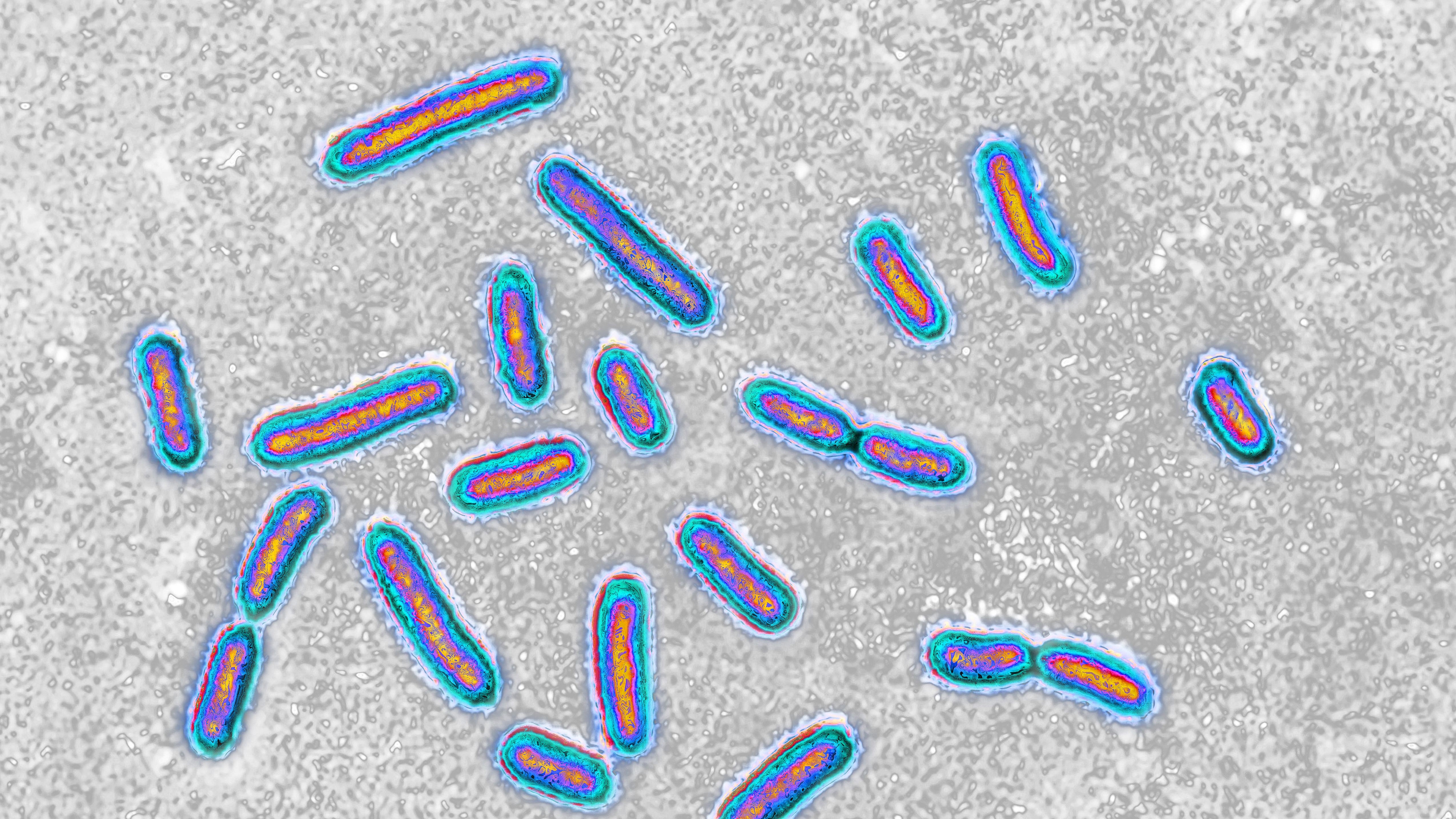 Pseudomonas aeruginosa as seen underneath a microscope.