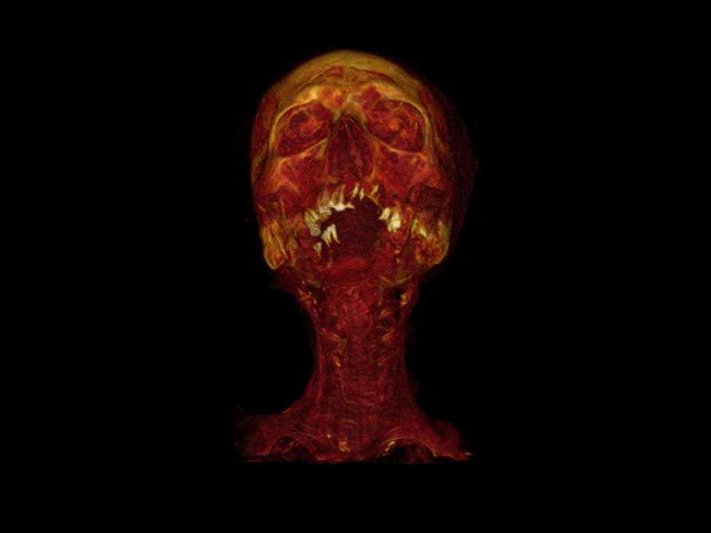 mummy-ct-scan