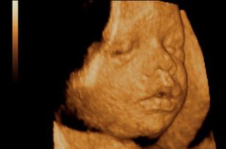 3D pregnancy image