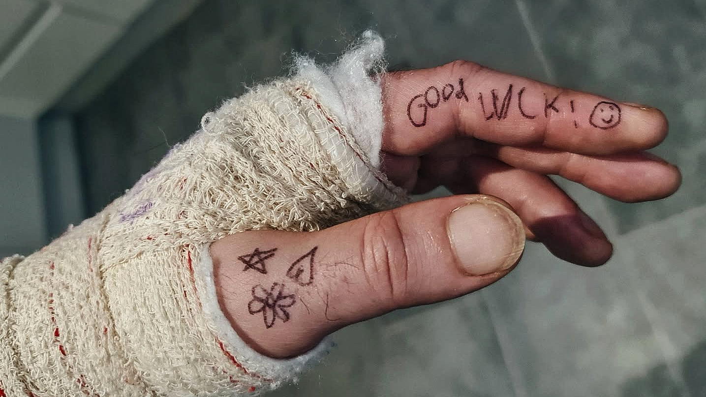 Acoustic guitarist Jon Gomm's hand in a cast following his fall from a stage on February 5, 2026. His hand features a flower, star and heart and the greeting &amp;quot;Good luck!&amp;quot; with a smiley face, all written in black pen