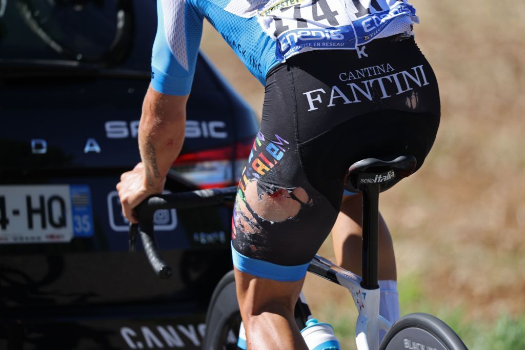 Team Israel Academy rider Frances Hugo Hofstetters injuries are pictured during the 7th stage of the 107th edition of the Tour de France cycling race 168 km between Millau and Lavaur on September 4 2020 Photo by KENZO TRIBOUILLARD AFP Photo by KENZO TRIBOUILLARDAFP via Getty Images