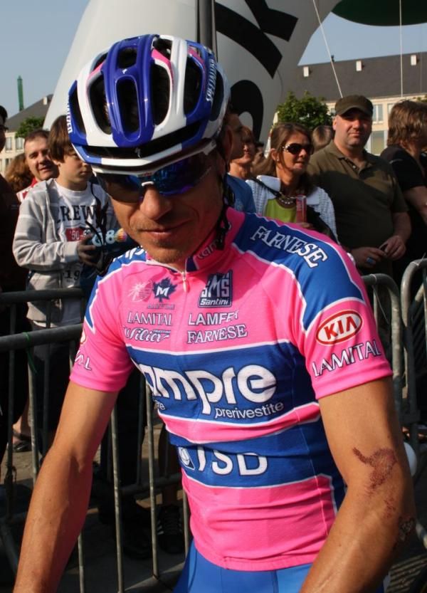 Damiano Cunego shows his scars after being hit by a flying bike at Fleche Wallonne