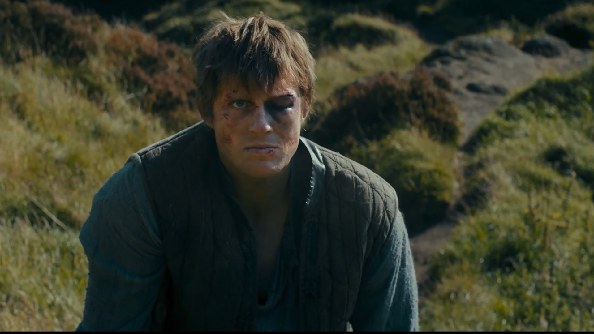 An angry looking Dunk with a swollen eye standing at the foot of a hill in A Knight of the Seven Kingdoms episode 6