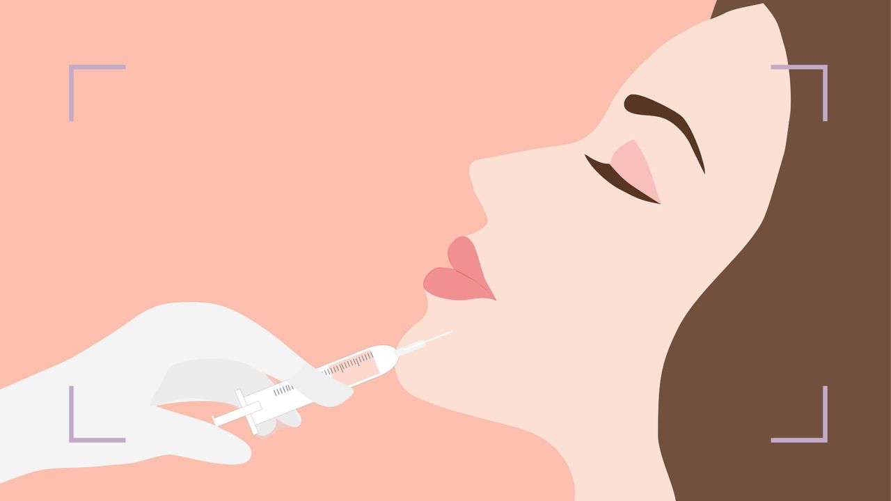 An illustration of a woman having filler, an alternative to botox, on a pink background 