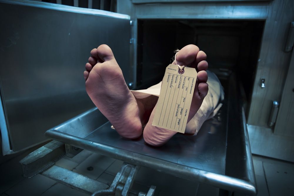 Photo of feet with toe tag, lying on a morgue table.