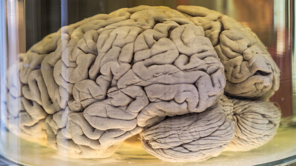 What Does A Real Human Brain Look Like