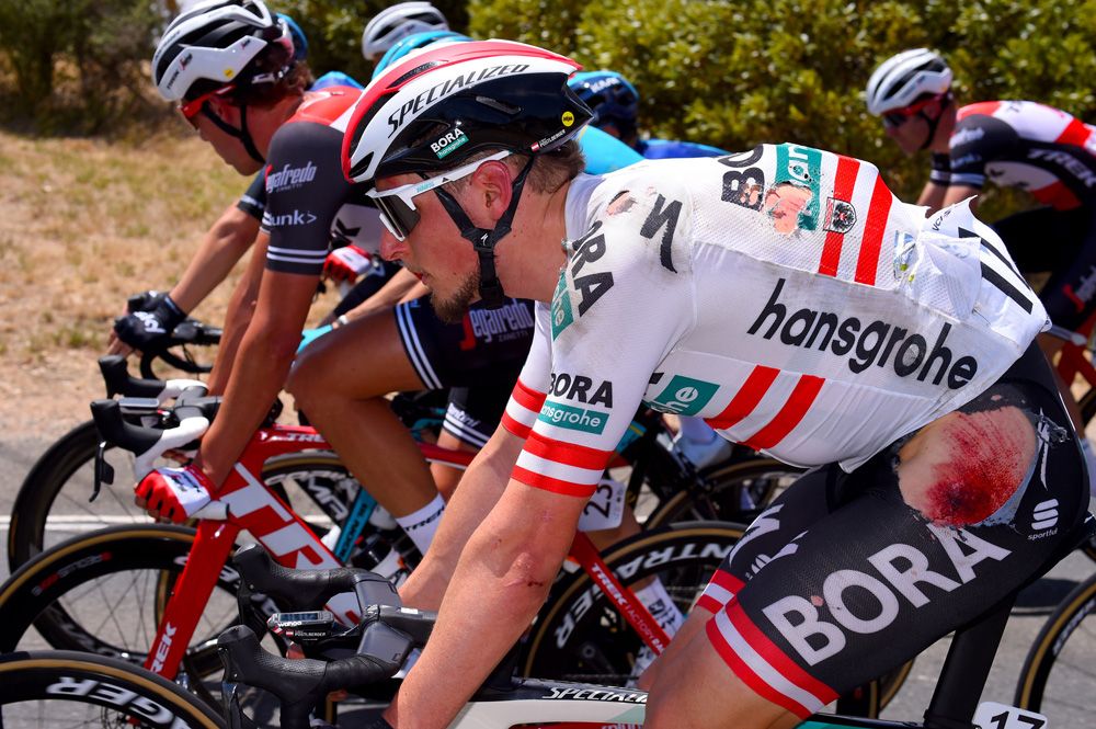 Lukas P&ouml;stlberger (Bora-Hansgrohe) suffered some nasty road rash