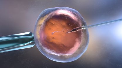 Photo illustration of in vitro fertilization