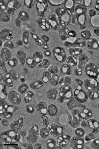 Bacteria containing granules of poly-hydroxyalkanoate (PHA) — a biodegradable polymer similar to the polypropylene used to make plastic packaging — inside their bacterial cell walls.