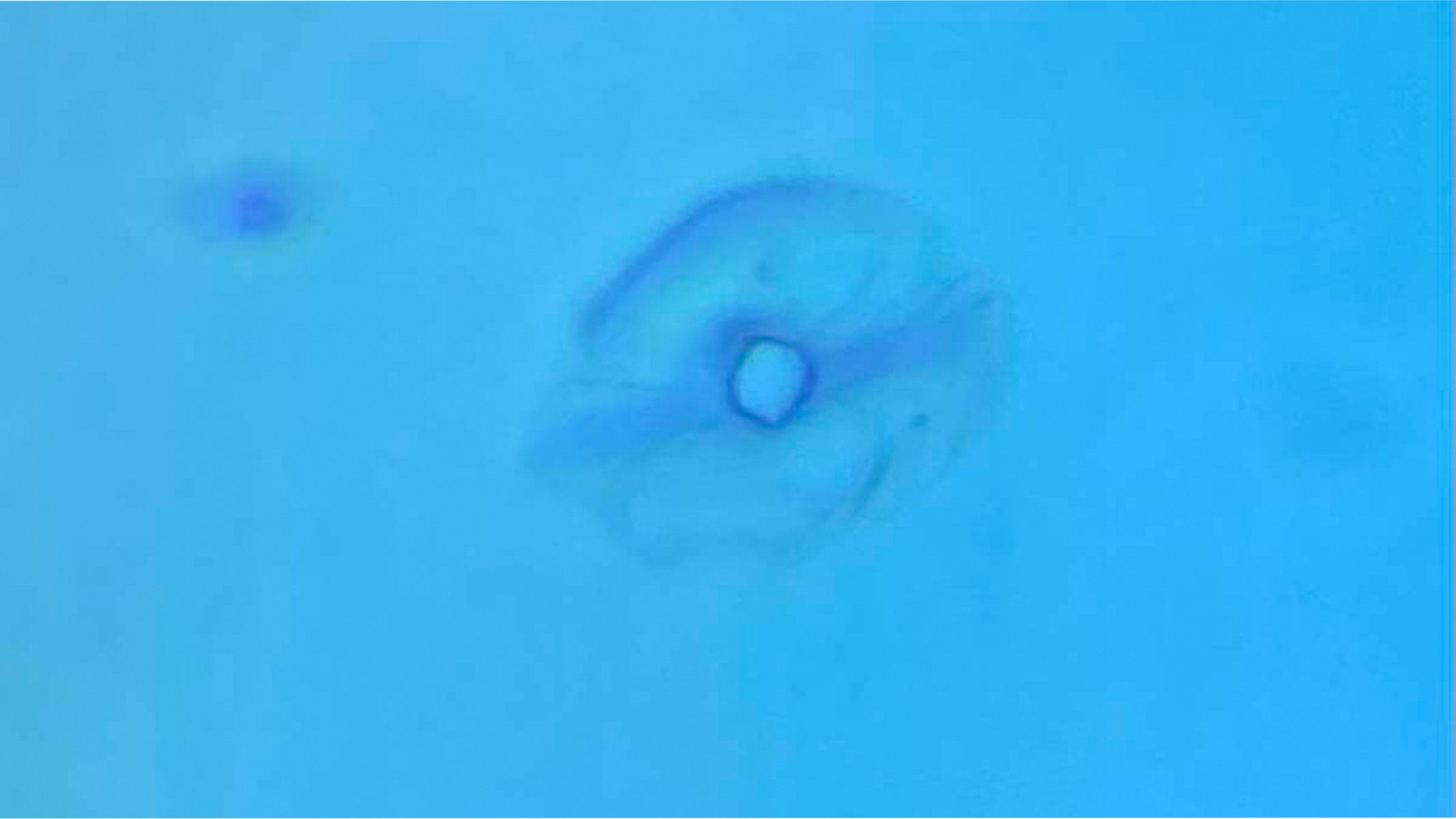 stomata under a microscope