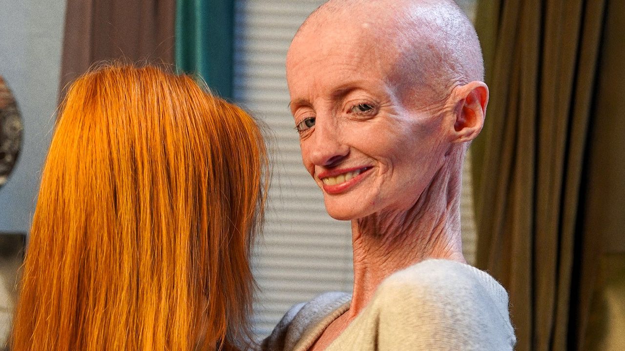 How to watch 'One Day in My Body' online from anywhere — stream TLC's intimate new medical docuseries