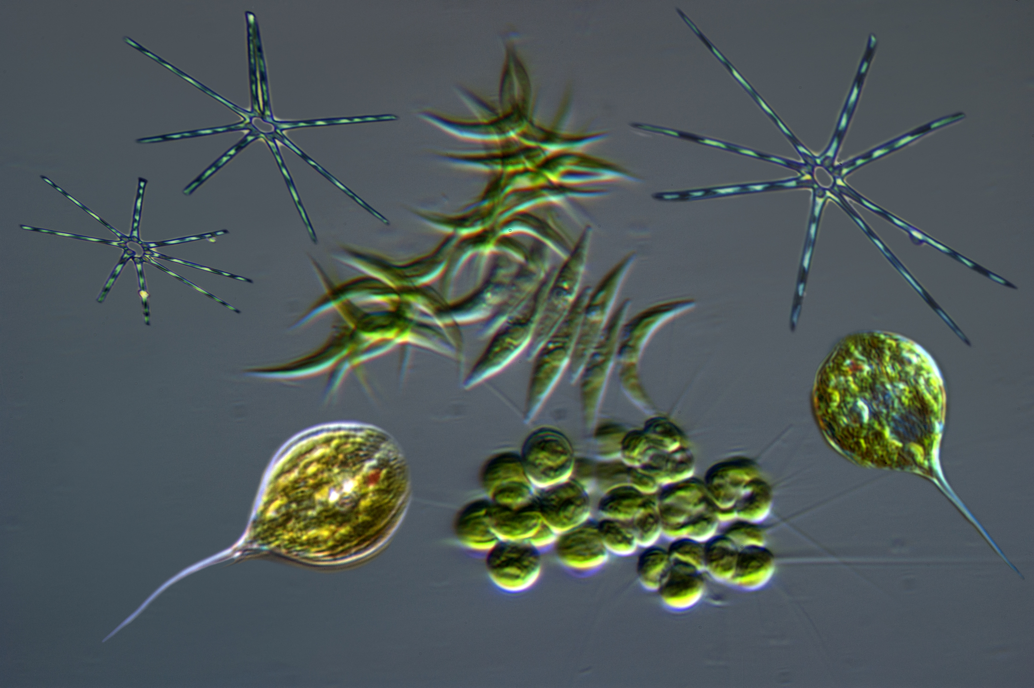 Phytoplankton as seen under the microscope.