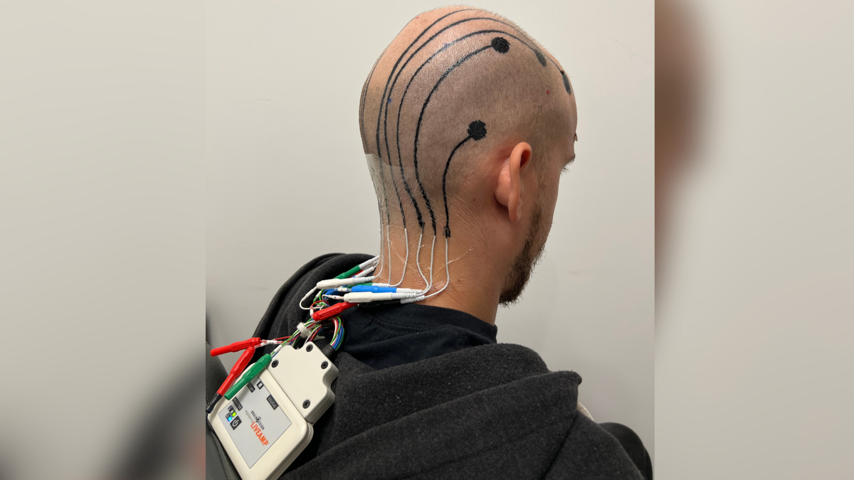 ‘Electronic’ scalp tattoos could be next big thing in brain monitoring