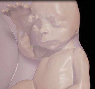 This is a close-up of fetus at 26 weeks.