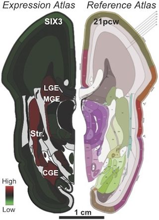 fetus brain map