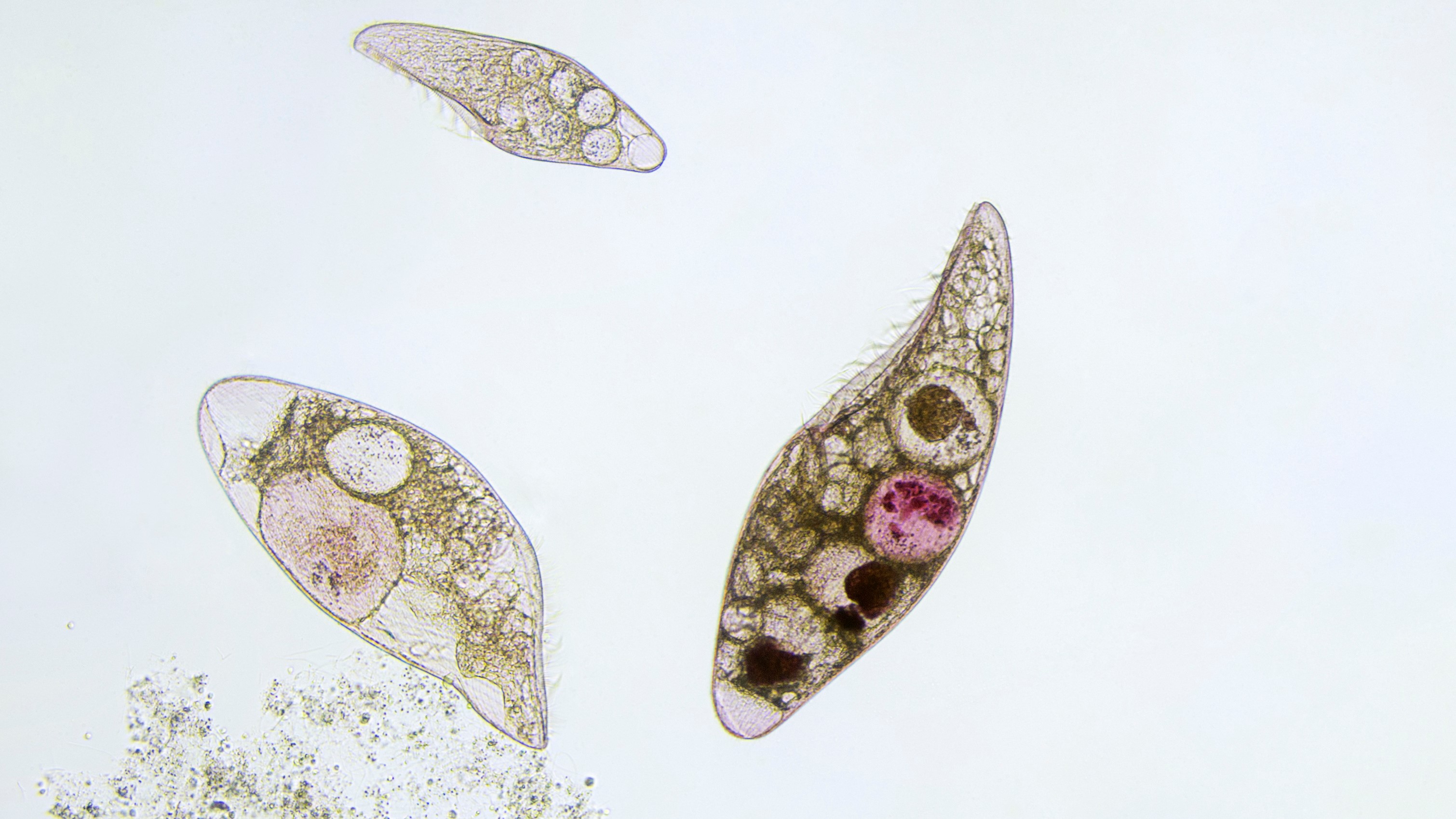 Ciliate Blepharisma americanum belongs to the protist kingdom. This image shows Blepharisma americanum in various stages of development.