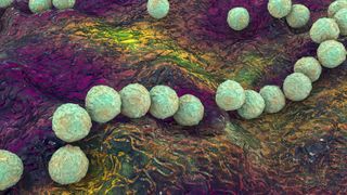 spherical bacterial cells shown growing on top of some sort of tissue