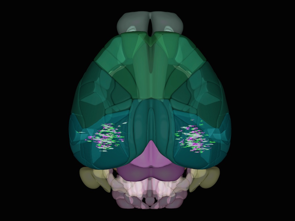 mouse brain