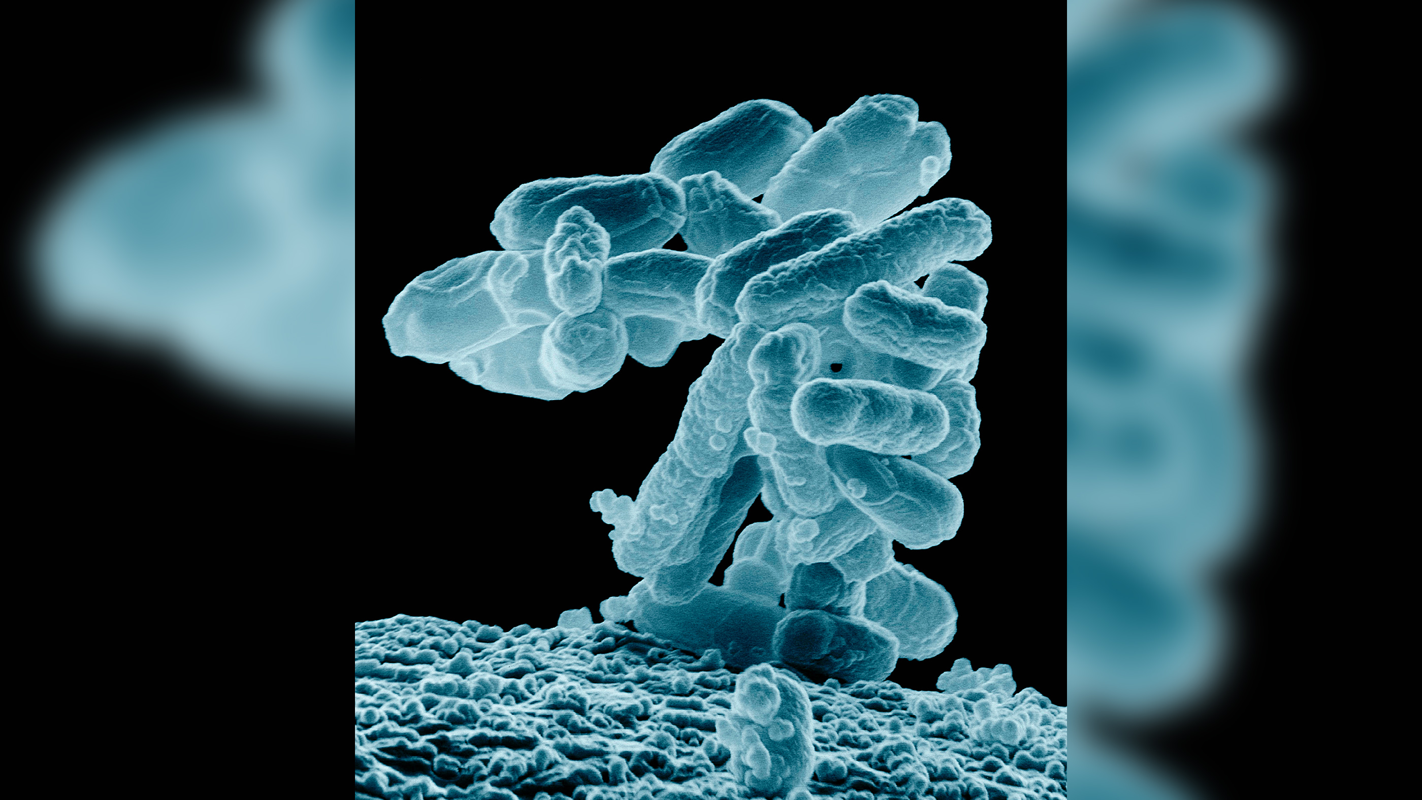 Researchers found first found the characteristic nucleotide repeats and spacers of Crisprs in the gut bacteria called E. Coli, shown here as a cluster in a scanning electron micrograph image.