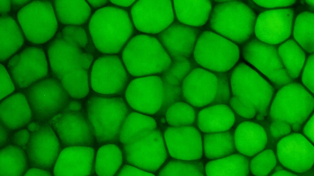 a microscope image of bubble wrap-like tissue, depicted in green