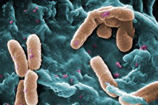 Some strains of Pseudomonas aeruginosa bacteria have become resistant to multiple antibiotics. 