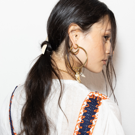 Iron Deficiency Hair Loss