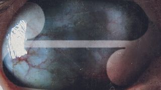 Filter album