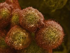Pancreatic Cancer Cells