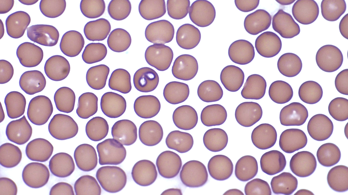 A photo of two Babesia organisms in a red blood cell of a dog.