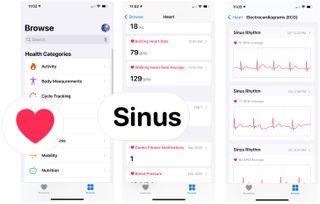 To view ECG data on the Health app for iPhone, open the Health app, then tap Browse at the bottom. Tap Heart, then choose Sinus Rhythm.