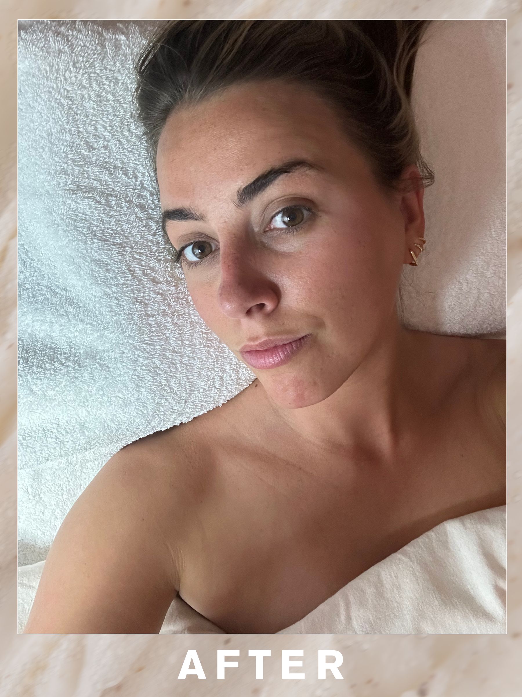 Shannon after her Skin Matters facial