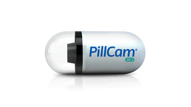2,000 patients screened for bowel cancer with PillCam, the camera you ...