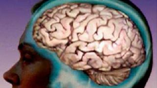 Human brain.