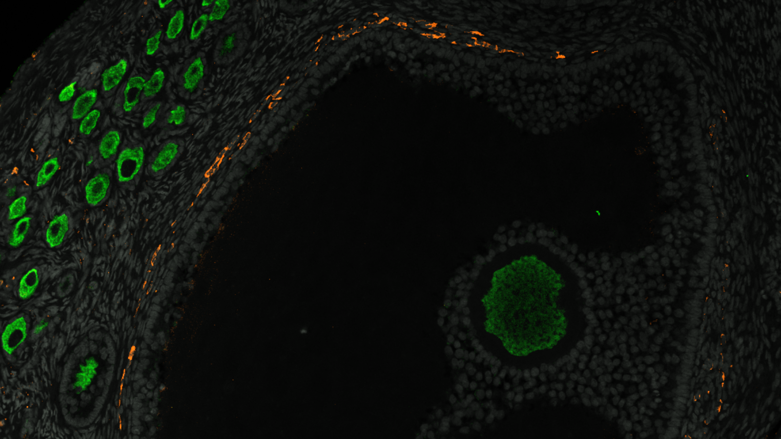 A section of monkey ovary showing the ovarian reserve on the left hand side