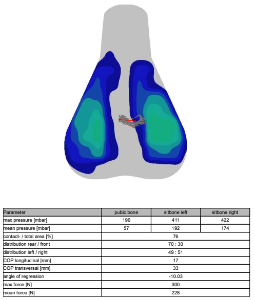 A visual output of saddle pressure mapping