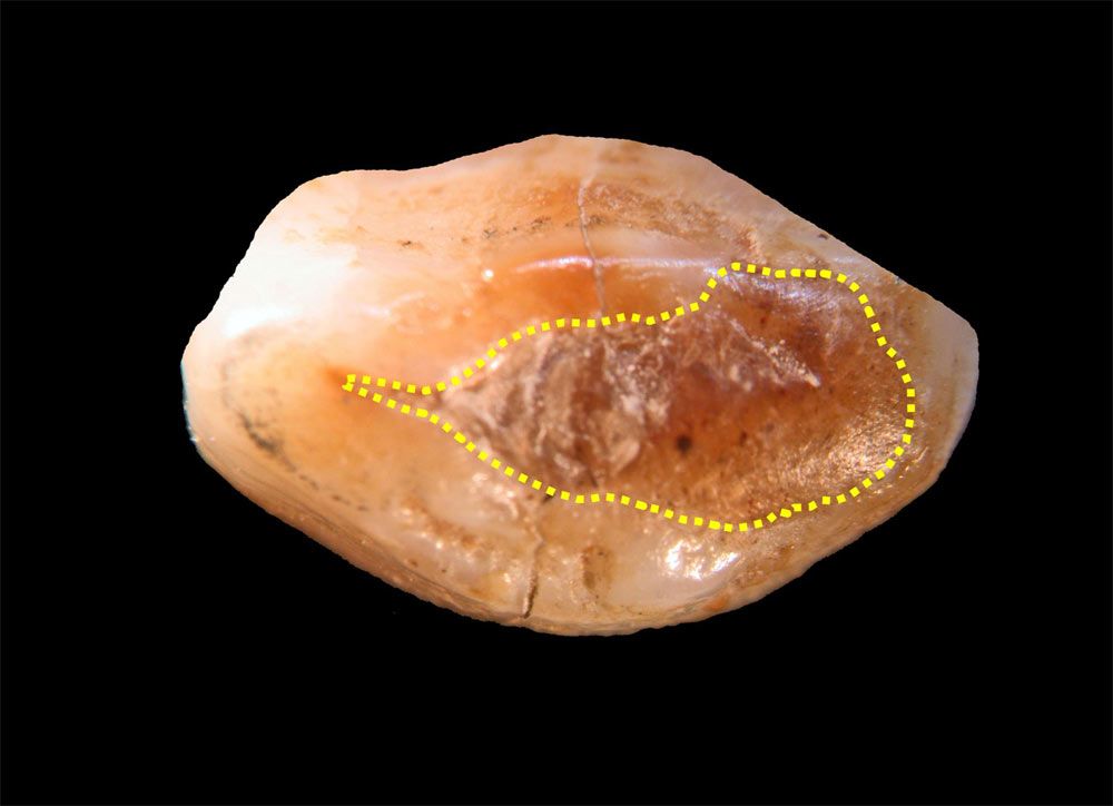 This is a microphotograph of the tooth crown in occlusal view with indication of the surface covered by beeswax (within the yellow dotted line).