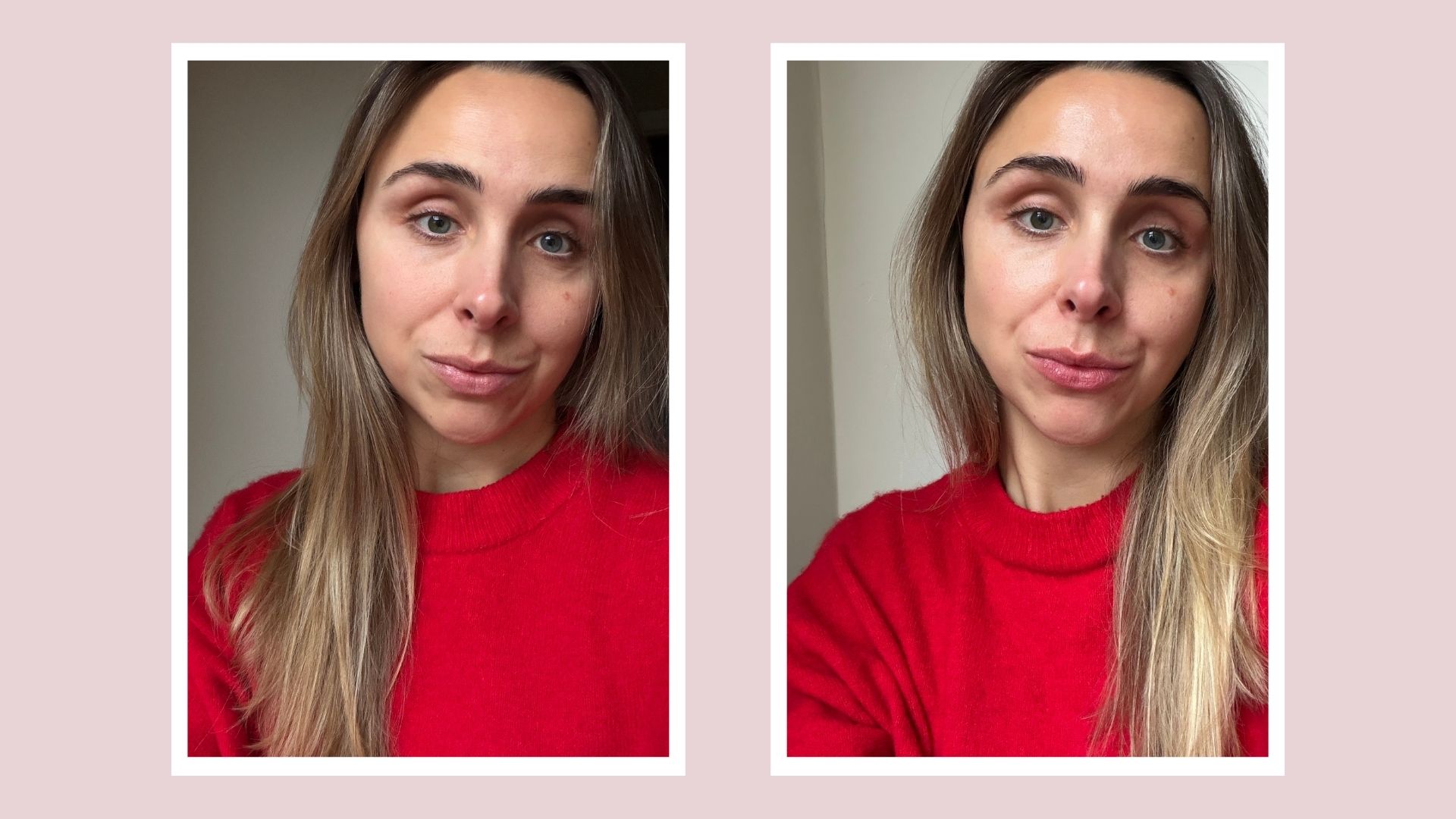 Two vertical images of Emma before using the Shark FacialPro Glow Depuffi (left) and after (right) in white frames and set against a pink background