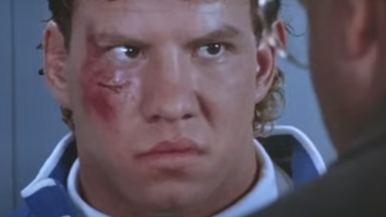 Tommy Morrison with a bruised face in Rocky V