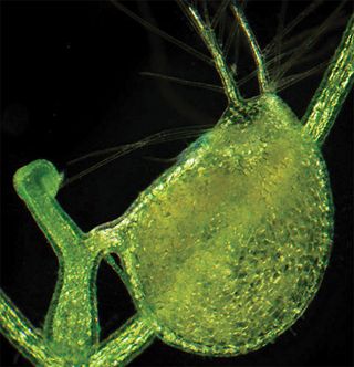 The genome of the carnivorous bladderwort plant (shown here in a light micrograph) is just 3 percent "junk DNA," suggesting such noncoding DNA is not crucial for complex life.