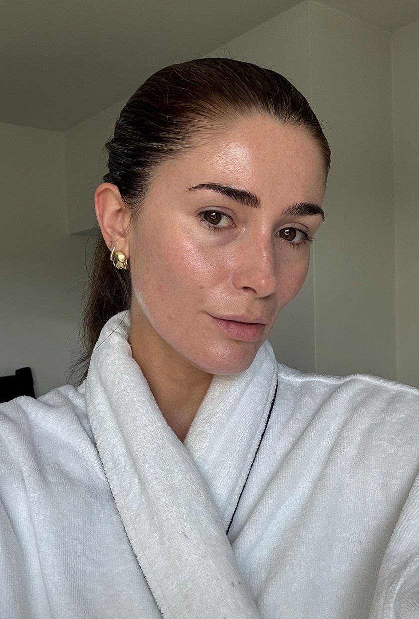 Eleanor after using Medik8 C-Tetra Advanced serum for two weeks