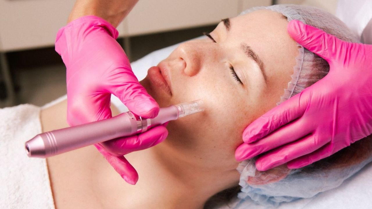 Microneedling